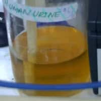 human urine
